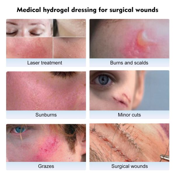 Secure Plus Medical hydrogel dressing kit for facial care, TGA APPROVED CLASS lla